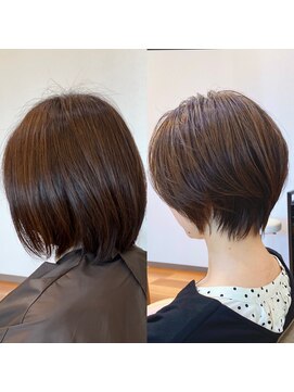 ロトヘアー(Roto hair) お客様Before&After 【Roto hair】