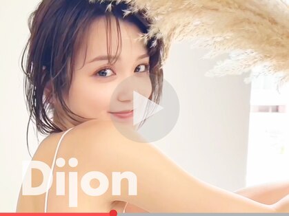 ディジョン(Dijon)の写真