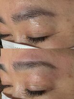 ラニ(Lani)&nbsp;ハリウッドブロウリフト