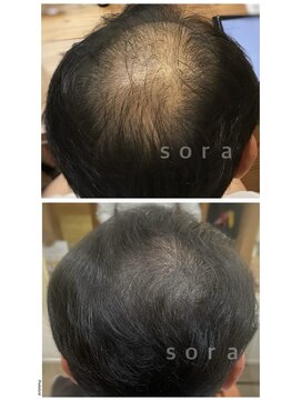 ソラ タニマチ(sora tanimachi) 頭皮ケア