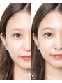 フェイスデコ アヴェダ セカンド(FACE DECO AVEDA/2nd)&nbsp;話題のハリウッドブロウリフトも施術可能です！