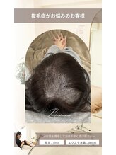 エクステサロンエム(EXTE SALON M)&nbsp;増毛エクステで抜毛症もカバー増毛エクステ/ヘアループ/エアエク