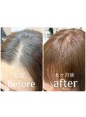 【前髪パックリの方へ】リセッターで自然な前髪に