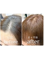 アンジュール ラナリア(1//jour LanaRia)&nbsp;【前髪パックリの方へ】リセッターで自然な前髪に