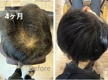 リブ(Live)の雰囲気（育毛促進の結果に期待を！真空ヘッドスパ頭頭脳プログラム☆）