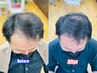 【新大久保】増 毛 エクステ【M字分かれが気になる人向け】400本コース