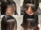 ソルア 上本町(solua)の写真