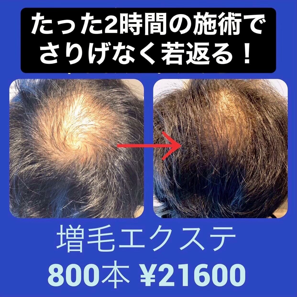 増毛エクステ800本：L258799598｜増毛エクステ専門店 エクステルーム