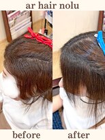 アールヘアノル(ar hair nolu) 髪質改善縮毛矯正 37