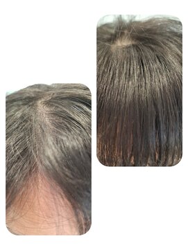 ユーフォルムギンザ(y-Forme Ginza) 話題のトキカタ♪前髪編