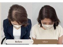 マイ ビューティー メンバーシップ サロン(MAI BEAUTY membership salon)の雰囲気（マイクロヘアタトゥーでお悩み解消価格以上の安心と保証をお約束）