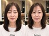 【縮毛矯正】　前髪や顔周りサラサラ♪部分矯正コース