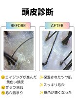 フリーダム 池下店(Freedom)&nbsp;【ヘッドスパ】頭皮ケア　頭皮診断　髪質改善　30代40代50代