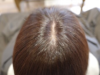 ヘアー ガーデン ロータス Hair Garden Lotusの写真/【ジアミンフリー！】カラー剤によるかぶれが気になる方などへ！髪と頭皮に優しいメニューをご提案します！