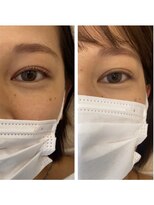 リルミー ミュエナ 大須 矢場町(Lilme myuena)&nbsp;まつ毛パーマの1ヶ月後　<原田>