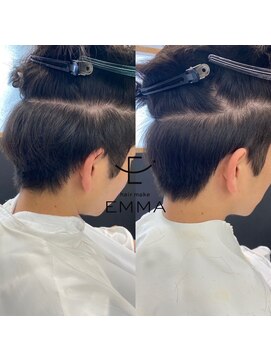 エマ(EMMA) ダウンパーマ