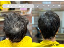 ダーディヘアネイル(dadi hair nail)の雰囲気（サロン１番人気「髪のボリュームアップ!!」頭皮ケアで願い叶う♪）