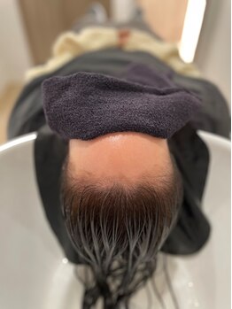 セイカ 姫路(SEIKA)の写真/細毛、抜け毛など頭皮のお悩みは様々。頭皮から綺麗にすることで、髪本来の健康的な美しさを取り戻します♪