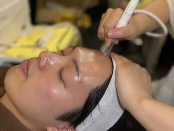 キャンチョメの写真/メンズ歓迎!床屋ならではの効果に焦点をおいたWAX脱毛＋フェイシャルエステ◎皮脂や毛穴汚れにアプローチ★