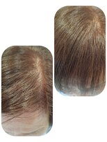 ユーフォルムギンザ(y-Forme Ginza)&nbsp;話題のトキカタ♪前髪編