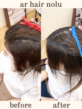 アールヘアノル(ar hair nolu) 髪質改善縮毛矯正 1