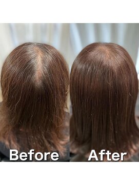 ツムグ 代官山 中目黒(TUMUGU) 地肌見え・つむじ割れ解消/ボリュームアップエクステ