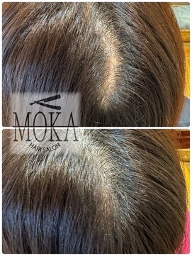 ヘアーサロン モカ(Hair salon MOKA) 特許増毛エクステ