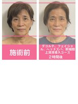 銀座ねむり姫 GINZA east店 しらゆきコース