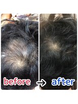 ルーミールーム(RoomieRoom)&nbsp;お悩み解決☆頭皮改善！メンズ育毛促進ケア