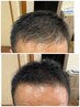 【未来への投資】カット+頭皮改善ケアで5年後の髪を守る｜金山メンズ