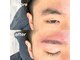 らふの写真