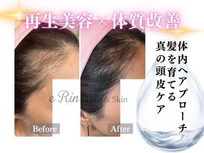 エリン(e Rin)の写真