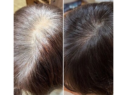 エフプロモーションヴァンカウンシルブリーズ(VAN COUNCIL BReeze)の写真