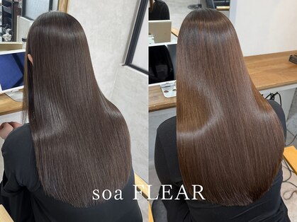 ソア フレア(soa FLEAR)の写真