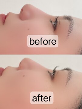 アローズ(arose) マツパ