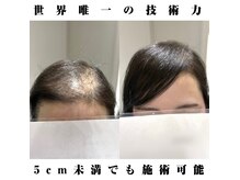 アンフィーロ(An filo)