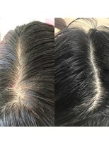 ルーミールーム(RoomieRoom)&nbsp;頭皮改善／ビフォア＆アフター