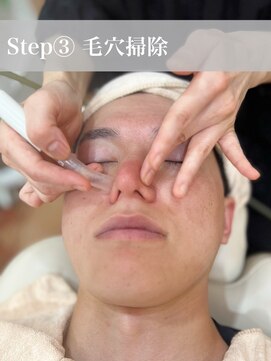 フェイスビュー(Face Beau) 【メンズシェービングエステコースのご紹介】3、毛穴掃除