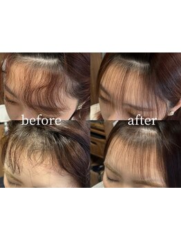 【Link】でしか体験できない幹細胞を使った唯一無二の髪質改善！くせやうねり、エイジング悩みにハリツヤを