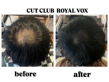 カットクラブロイヤルヴォックス(CUT CLUB ROYALVOX)の写真/毛穴ケアや抜け毛予防のためにメンズヘッドスパメニューが充実◎年齢を重ねるごとにカッコよくなれる！