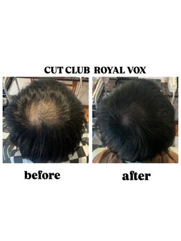 毛穴ケアや抜け毛予防のためにメンズヘッドスパメニューが充実◎年齢を重ねるごとにカッコよくなれる！