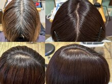 【白髪ぼかしカラー】白髪染めを使わないでダメージを最小限に！白髪が気になり出した方も、すでにある方も