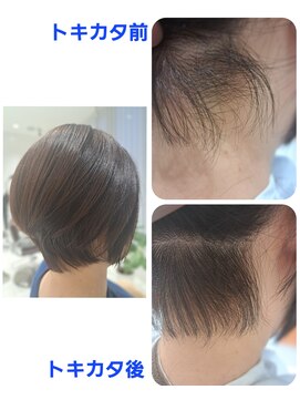 ユーフォルムギンザ(y-Forme Ginza) 話題のトキカタ♪えり足編