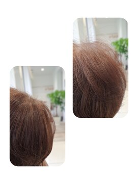 ユーフォルムギンザ(y-Forme Ginza) 話題のトキカタ♪頭頂部編