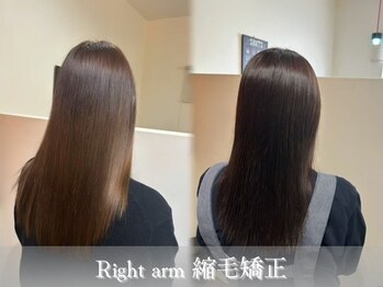 Right arm