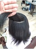 ノーアイロン矯正　ポイント　オーバーゾーン