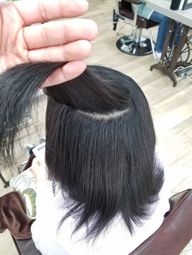 ルーミールーム(RoomieRoom) ノーアイロン矯正　ポイント　オーバーゾーン