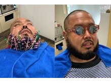 ヘアーササキ(Hair SASAKI)の雰囲気（髭パーマスキンフェードスタイル写真です<理容室>☆メンズ）