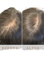 エクステサロンエム(EXTE SALON M) 分け目の透け感カバー!後ろからや上からの視線を無くしましょう!