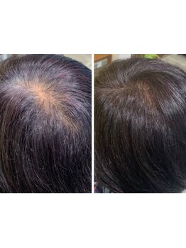 ヘナカラー・ノンジアミンカラーで髪と頭皮に優しく染められる♪エイジング毛のお悩みにもオススメです！